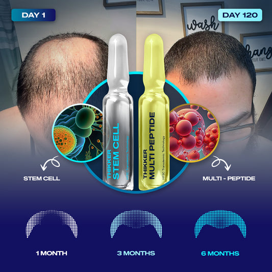 THIKKER Complete Hair Cycle Therapy 2.0