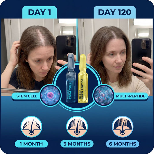 THIKKER Complete Hair Cycle Therapy 2.0 for Women
